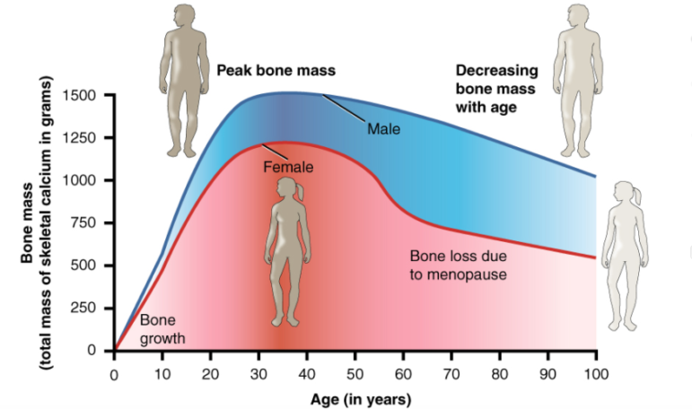 Osteoporosis chart Wikimedia Commons User:CFCF OpenStax College 06-15-17